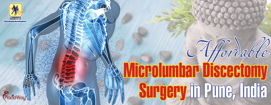 Effective Microlumbar Discectomy in India